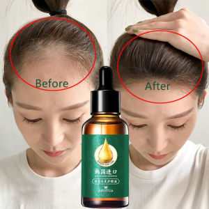 Ginger Hair Loss Nutritional Solution Prevent hair loss and regrowth Increase Hair Density Leave-in Hair Treatment Oil Improves hair follicles Nourishes Hair Roots Frizzy Scalp Treatment 30ml Hair Care Serum