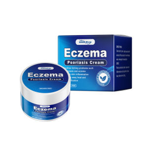 กลากโรคสะเก็ดเงินครีมบรรเทาสีแดงบวม Anti-Inflammatory เหมาะสําหรับปัญหาผิวต่างๆสมุนไพร Antipruritic Ointment