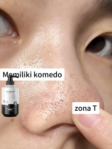 Face Wash Pria 500ml – Pembersih Wajah Anti Jerawat & Komedo Kontrol Minyak Melembapkan Kulit