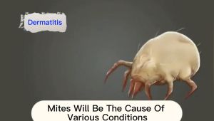 【Spot Authentic Guarantee】MLJ® bed bug killer spray bed bugs killer powerful spray bed bugs spray bed bugs killer powerful bed bugs and mites spray anti mite spray除螨喷雾剂螨虫喷雾剂