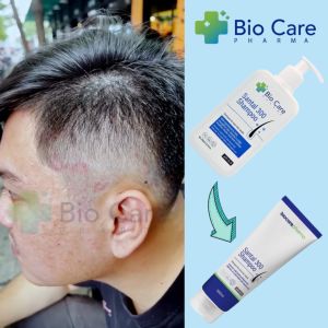 Dầu Gội Thảo Dược Biocare Pharma Santa 300 Shampoo (200ml) Chính Hãng Giảm Gàu Ngừa Nấm Da Dầu