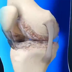 [SG Ready Stock] Knee Booster Support Knee Pad Knee Sleeve Knee Braces Elastic Knee Pads Booster Sports Safety Injury Recovery Knee Protection Booster