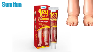 krim bengkak 20g leg edema cream ubat surut bengkak kaki membantu melancarkan darah kurangkan bengkak dan kesakitan 消肿膏