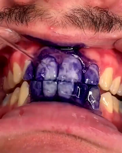 hismile v34 colour corrector my smile Toothpaste Teeth Whitening Tooth Stain Removal Purple serum kit Against Sensitive Teeth Whitening Toothpaste