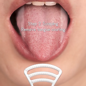 Tongue Cleaner Scrapper Oral Care Dental Clean Reusable Tongue Brush Pencuci Lidah Pembesih舌苔清洁刷-RANDOM COLOR