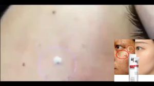 Penghilang flek hitam- Krim Dark spot removal cream 20g Niacinamide Whitening Cream-Bintik noda obat flek hitam paling ampuh Hitam Membandel