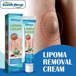 South Moon Lipoma Removal Cream Fat Granule Care Cream Lipolysis Fat Lump Relieve Plaster Fatty Cellulite Cream Relief Ointment Lipoma Cream