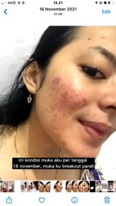 Tiens Spirulina Mask - Masker Muka Face Mask Skincare Spirulina