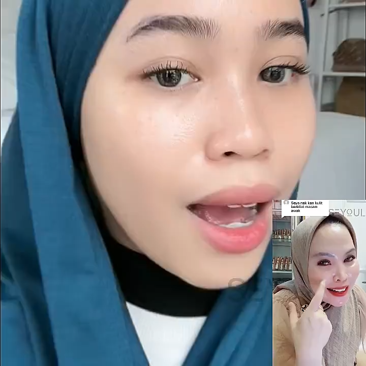 SEYOUL 21 DAYS SERUM | Melasma Freckles Large pores Helps the skin become bright and healthy