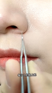 (BISA COD) PROMO PINSET KOMEDO STAINLEES STEEL / PINSET JERAWAT / JEPITAN KOMEDO / BLACKHEAD TWEEZER