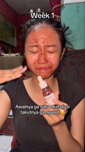 Cleora Glow Skin Exfoliator Package Special Bundle 2in1 - Exclusive Glow Jelly Booster Vit C + Red Saviour Exfoliating Serum Scrub Wajah Paket Skincare Peeling Wanita Pria Serum Jerawat Anti Acne Moisturizer Pelembab Pemutih