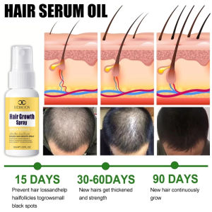 Ginger Hair Growth Spray Serum Rambut 30ML Anti Hair Loss Serum Promotes grow thicker hair and get rid of hair loss troubles