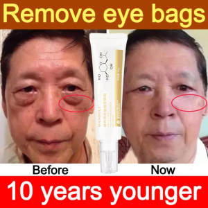 【Hot in Korea】Anti-Aging Eye Cream Peptide Firming Eye Essence Fade Dark Circles Eye Bag Essence Oil Moisturizing Anti-Aging Fade Fine Lines Eye Bag Skincare 30g