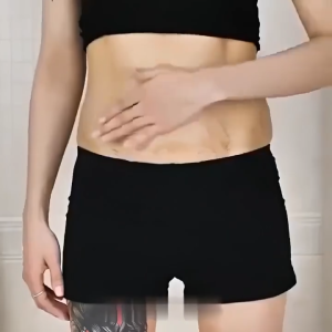 [NEW] Sadoer Stretch Mark Cream Penghilang Strechmark Ampuh Permanen Stretch Mark Dan Obesity Mark