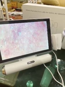 Máy soi da Meiboyi Plus thế hệ mới | Máy soi da 11 inch mẫu mới 2023