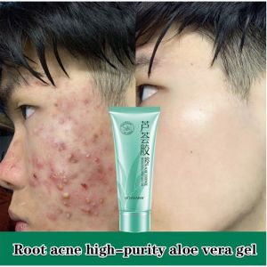 100% Aloe Vera Organic From Freshly Cut Aloe Leaves Moisturizing Skin Skin Care for Deeply & Rapidly Soothing Moisturizing Aloe Vera Gel 40g 祛痘芦荟胶