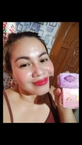 Pekas Eraser Cream Melasma Pekas & Freckles Remover by Capadosa Spots Blemishes and Darks Spot Anti Aging Facial Moisturizers Skin Care Botox Whitening Cream Beauty Products