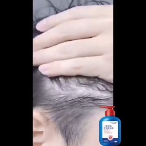 Dầu gội trị gàu Selenium disulfide 300ML ngứa nhanh kháng khuẩn phục hồi viêm da giúp gàu rụng tự nhiên chăm sóc cá nhân