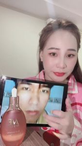 Tái Tạo Amee SKin Peel Da Sinh Học Trị Nám Mụn Thâm