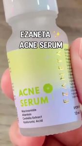 EZANETA - Acne Serum 10 ML BPOM Solusi Jerawat dan Kulit Berminyak