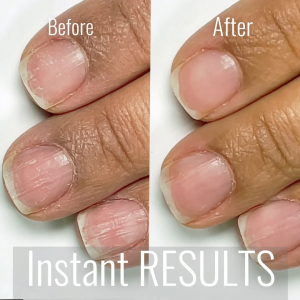 LONDONTOWN PROBIOTIC INSTANT NAIL BOOST | transformative nail mask for thin weak nails