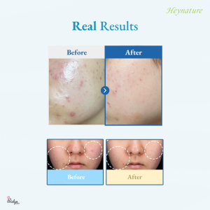 Heynature Erseongcho Heartleaf (Moisturising) Toner 200ml