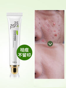 Kem Phục Hồi Vết Thâm Mụn Aloe Vera Gel Giảm Đỏ Sẹo Mụn Lỗ Chân Lông Dưỡng Ẩm Chống Lão Hóa Làm Đẹp Da Mặt