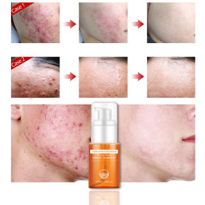 นิสิตเซรั่มแท้ เซรั่ม นิสิต เซรั่มยกกระชับ เซรัมหน้าขาวใส เซรั่มลดสิว vibrant glamour serum 30ML