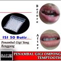 PROMO Temptooth temporary Tooth Buat Gigi Palsu Sendiri. 