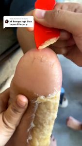 Tumitku: Solusi Terbaik untuk Kaki Pecah-Pecah dan Kering Parah