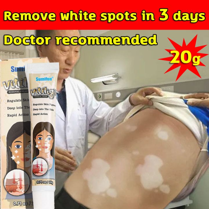 рџ ґ 100 Effective рџ ґ Sumifun Vitiligo Treatment Cream 20g Treat Vitiligo рџ ґ 100 Effective рџ ґ Sumifun Vitiligo Treatment Cream 20g Treat Vitiligo