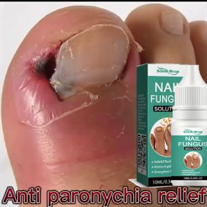 Serum Kuku Berjamur Dan Rusak Obat Kuku Berjamur Dan Rusak Obat Jamur Kuku Paling Ampuh Obat Kuku Jempol Kaki Rusak Obat Kuku Rusak Paling Ampuh