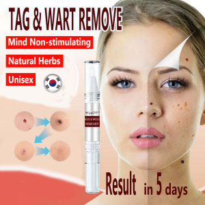 WIPEOFF TAGS MOLES REMOVER Skin Tags And Warts Remove Original Kasoy Oil Warts Remover 100% Natural Herbal Non-irritating Mole Removal Pen Smoothing Skin Wart-fighting Care Solution Natural and Effective Scar-free Organic Facial Solution For Men And Women