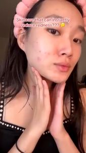 SKIN1004 Madagascar Centella Toning Toner 210ml - Mengandung Centella asiatica moisturising dan exfoliating