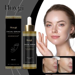Huyết Thanh Dưỡng Sáng Da Hoygi 30ml Với Vitamin E Và Tinh Chất Trầm Hương Nhẹ Dịu Không Gây Nhờn Tăng Cường Độ Sáng Cho Da Xỉn Màu
