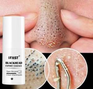 Advanced Blackhead Removal Essence (30ml): For Clear Refined Skin