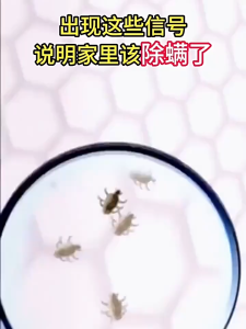 Mite Removal Spray Home Use | Bedding Mattress Fabric Cleaner Anti Dust Mite Fresh Care | Safe for Daily Use 除螨喷雾家用床品清洁 | 被子床垫去螨清新护理 | 宿舍母婴可用除螨喷雾