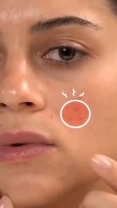 COD Stiker Jerawat 36Pcs Acne Pimple Patch Sticker Transparan Polos Untuk Harian Menutup Jerawat
