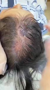 💗🙋‍♀️💗生发液增发密发修复发根头皮发际线密发蓬松植物防脱育发液增发液