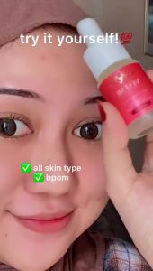 VESTME Paket Glow Booster Red Jelly & Acne Serum [2 in 1] - BPOM