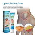 SOUTHMOON LIPOMA REMOVAL CREAM krim pembersih lipoma limfa ketulan keras ketiak leher belakang telinga buang detox badan. 