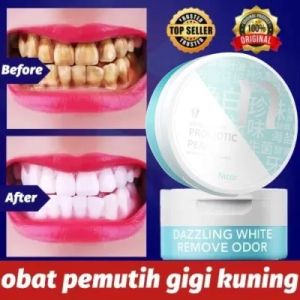 Teeth Whitening Powder-pemutih Gigi Dan Penghilang Karang Gigi-pemutih Gigi Kuning-Arang Pemutih Gigi-pemutih Gigi Kuning-pemutih Gigi-Gigi Odol Pemutih-Oral Care Teeth Whitening-pemutih Gigi Kuning Permanen Cepat Ori-bubuk Ampu Gigi