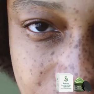 EELHOE Krim Pemutih Penghilang Noda yang Ampuh Mencerahkan Kulit dengan Cepat Menghilangkan Pigmentasi Melanin Melasma Flek Hitam Melembabkan Bintik-bintik Krim Pemutih