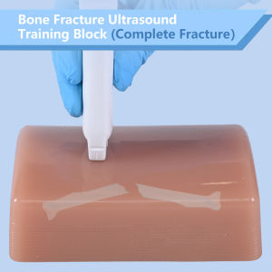1pc Bone Fracture Ultrasound Training Block - Complete Fracture Model for Medical Ultrasound Education & Training TPE Material Medical Training Aid | Realistic Training Aid | Durable Training Block Bone Scan Training Aid