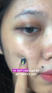 PROMO 2PCS CHALONESE Moisturizer Brightening Gel 50gr & Day Cream Night Cream