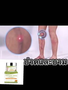 รักษาสวยใบหน้า การรักษาเส้นเลือดขอด ครีมทาเส้นเลือดขอด แมงมูม ฟื้นบำรุงผิว การบรรทัด และบรรทัดหลังการรักษา รักษาขาให้สวย บรรทัด รักษา Varicose Vein Cream 50g
