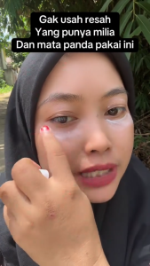 krim herbal vitamin E penghilang milia bintik lemak fat granule mata hidung 20g krim penghilang milia syringoma xanthelasma butiran lemak sekitar mata