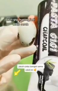 Pasta Gigi SR12 Charcoal - Odol Pemutih Gigi Bebas Bau Mulut dan Plak