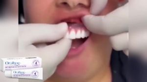 oralhoe | Oralhoe Denture Adhesive Long Lasting Fixation Denture Glue for False Teeth Denture Care Comfortable Portable Denture Fixing Gel