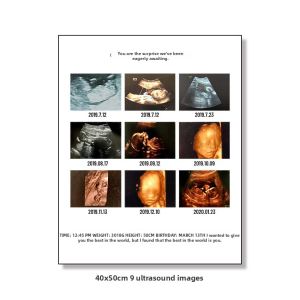 yishujia office | Customized HD Print Ultrasound Image Frame